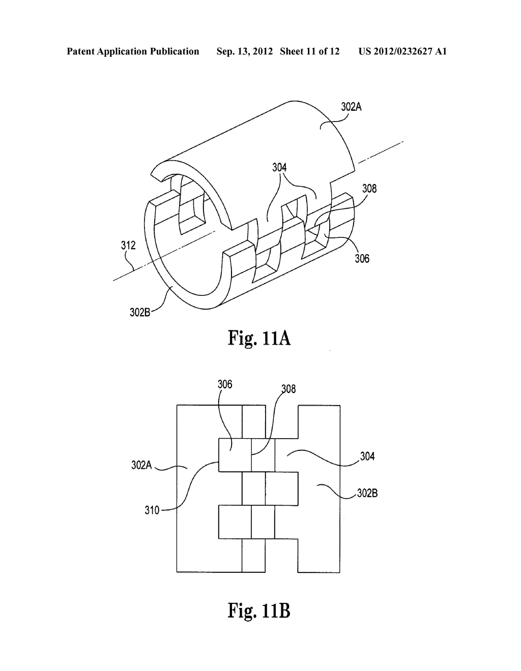 PRE-SUTURED ANCHOR FOR IMPLANTABLE LEADS - diagram, schematic, and image 12