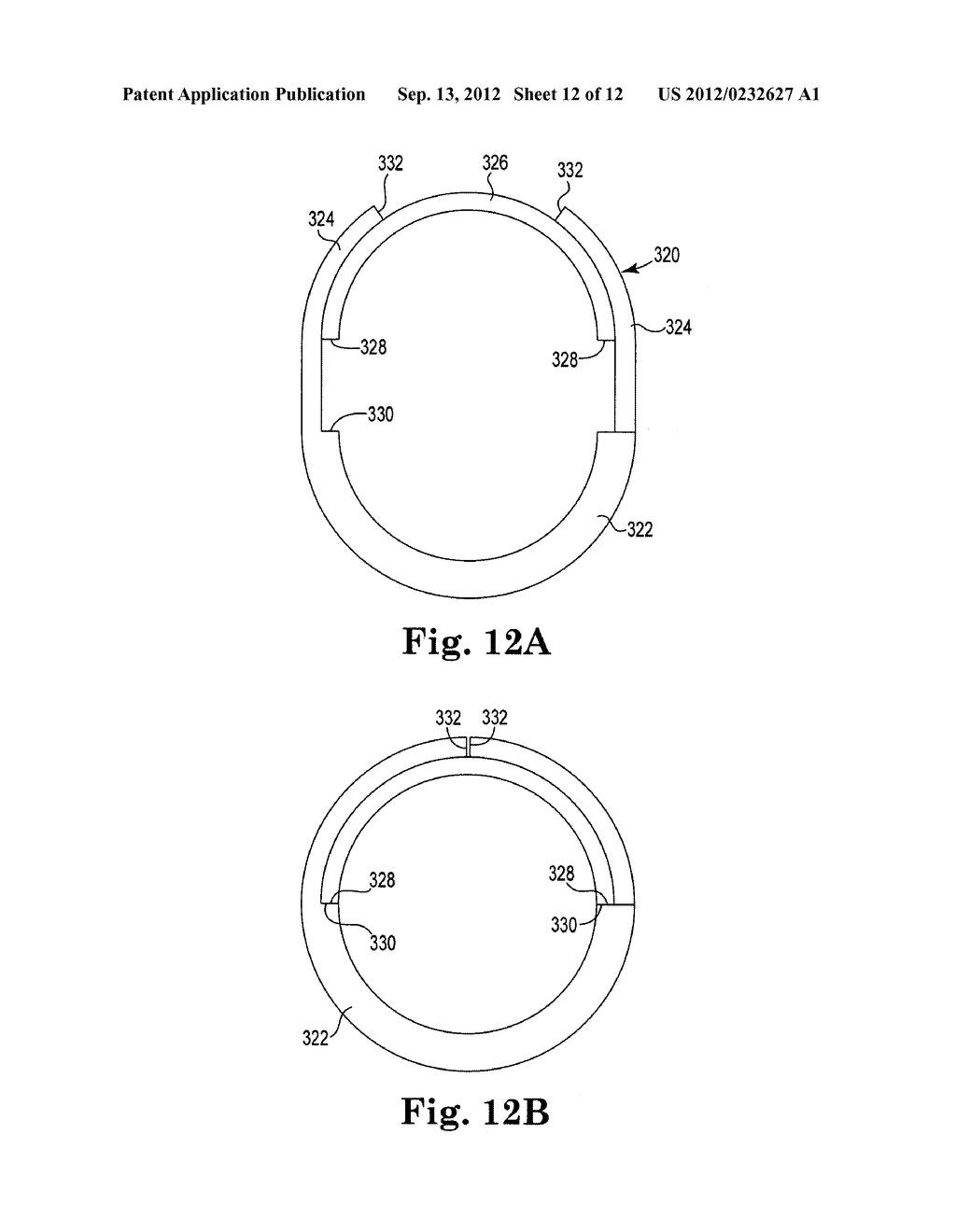 PRE-SUTURED ANCHOR FOR IMPLANTABLE LEADS - diagram, schematic, and image 13