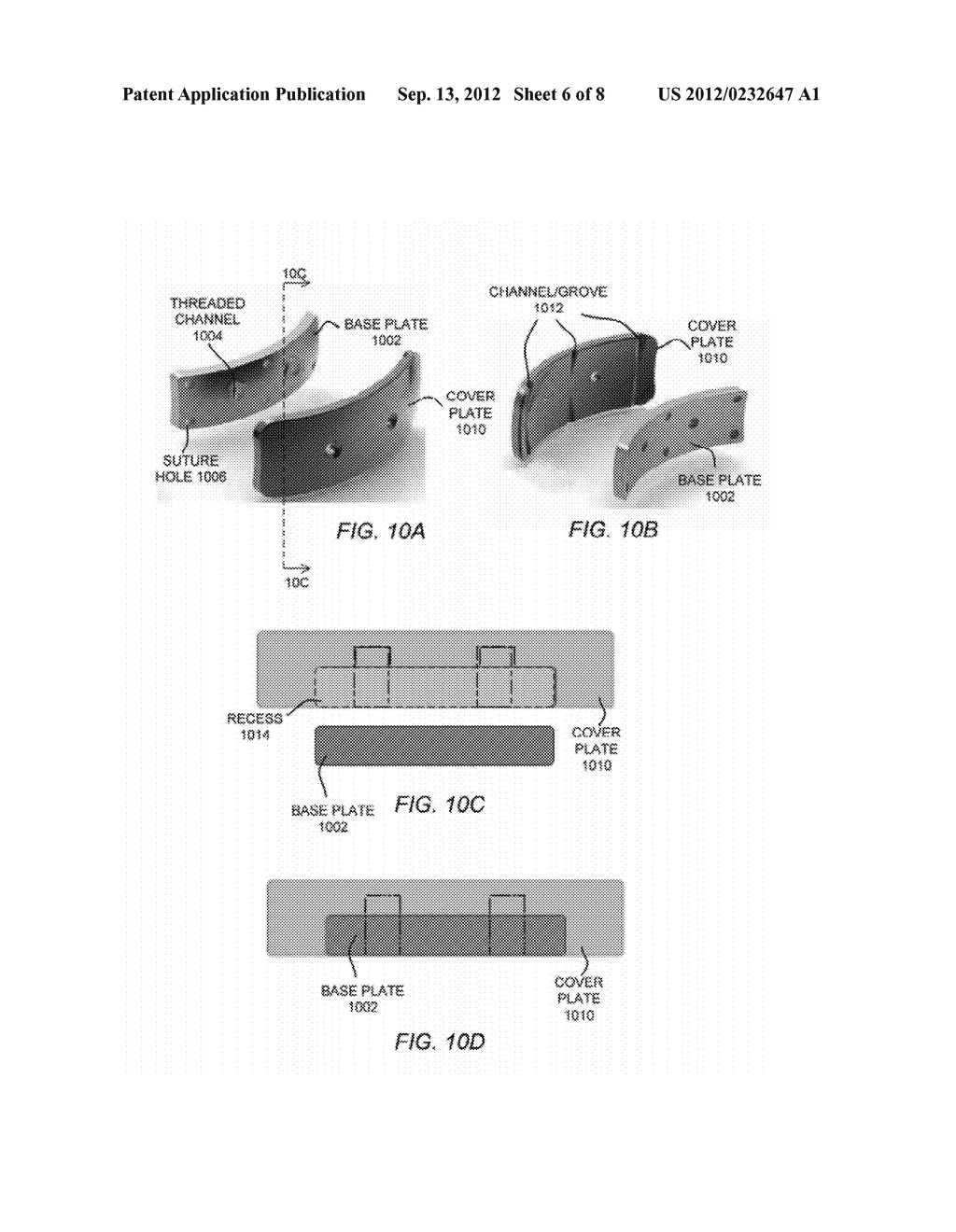 ADJUSTABLE WEIGHTED EYELID CLOSURE DEVICES AND METHODS - diagram, schematic, and image 07