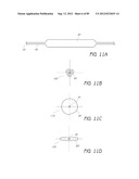 MINIMALLY INVASIVE TISSUE SUPPORT diagram and image