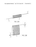 MINIMALLY INVASIVE TISSUE SUPPORT diagram and image