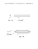 MINIMALLY INVASIVE TISSUE SUPPORT diagram and image