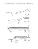 MINIMALLY INVASIVE TISSUE SUPPORT diagram and image