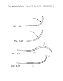 MINIMALLY INVASIVE TISSUE SUPPORT diagram and image