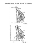 MINIMALLY INVASIVE TISSUE SUPPORT diagram and image