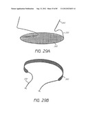 MINIMALLY INVASIVE TISSUE SUPPORT diagram and image