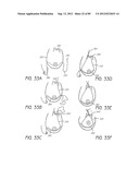 MINIMALLY INVASIVE TISSUE SUPPORT diagram and image