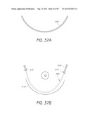 MINIMALLY INVASIVE TISSUE SUPPORT diagram and image