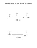 MINIMALLY INVASIVE TISSUE SUPPORT diagram and image