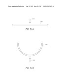 MINIMALLY INVASIVE TISSUE SUPPORT diagram and image