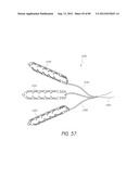 MINIMALLY INVASIVE TISSUE SUPPORT diagram and image