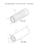 MINIMALLY INVASIVE TISSUE SUPPORT diagram and image