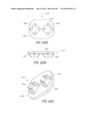 MINIMALLY INVASIVE TISSUE SUPPORT diagram and image