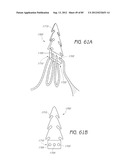 MINIMALLY INVASIVE TISSUE SUPPORT diagram and image