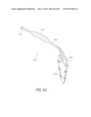 MINIMALLY INVASIVE TISSUE SUPPORT diagram and image