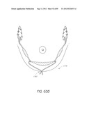 MINIMALLY INVASIVE TISSUE SUPPORT diagram and image