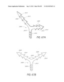 MINIMALLY INVASIVE TISSUE SUPPORT diagram and image