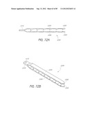 MINIMALLY INVASIVE TISSUE SUPPORT diagram and image