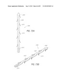 MINIMALLY INVASIVE TISSUE SUPPORT diagram and image