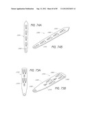 MINIMALLY INVASIVE TISSUE SUPPORT diagram and image