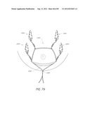 MINIMALLY INVASIVE TISSUE SUPPORT diagram and image