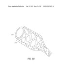 MINIMALLY INVASIVE TISSUE SUPPORT diagram and image