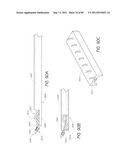 MINIMALLY INVASIVE TISSUE SUPPORT diagram and image