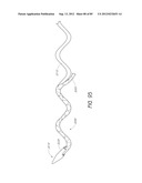 MINIMALLY INVASIVE TISSUE SUPPORT diagram and image