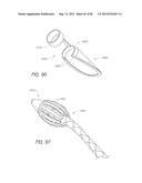 MINIMALLY INVASIVE TISSUE SUPPORT diagram and image