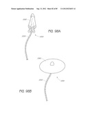 MINIMALLY INVASIVE TISSUE SUPPORT diagram and image