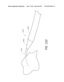 MINIMALLY INVASIVE TISSUE SUPPORT diagram and image