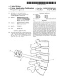 METHOD AND APPARATUS FOR MINIMALLY INVASIVE INSERTION OF INTERVERTEBRAL     IMPLANTS diagram and image
