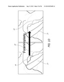 METHOD AND APPARATUS FOR MINIMALLY INVASIVE INSERTION OF INTERVERTEBRAL     IMPLANTS diagram and image