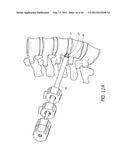 METHOD AND APPARATUS FOR MINIMALLY INVASIVE INSERTION OF INTERVERTEBRAL     IMPLANTS diagram and image