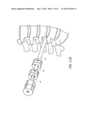 METHOD AND APPARATUS FOR MINIMALLY INVASIVE INSERTION OF INTERVERTEBRAL     IMPLANTS diagram and image