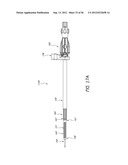 METHOD AND APPARATUS FOR MINIMALLY INVASIVE INSERTION OF INTERVERTEBRAL     IMPLANTS diagram and image