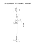 METHOD AND APPARATUS FOR MINIMALLY INVASIVE INSERTION OF INTERVERTEBRAL     IMPLANTS diagram and image