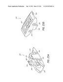 METHOD AND APPARATUS FOR MINIMALLY INVASIVE INSERTION OF INTERVERTEBRAL     IMPLANTS diagram and image