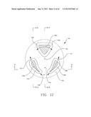 MULTI-LOBE ARTIFICIAL SPINE JOINT diagram and image