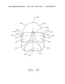 MULTI-LOBE ARTIFICIAL SPINE JOINT diagram and image