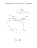 MULTI-LOBE ARTIFICIAL SPINE JOINT diagram and image