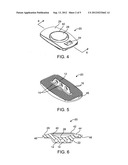 ARTIFICIAL INTERVERTEBRAL DISC PLACEMENT SYSTEM diagram and image