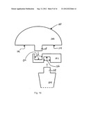 HUMERAL JOINT REPLACEMENT COMPONENT diagram and image