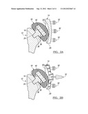 SHOULDER PROSTHETIC diagram and image