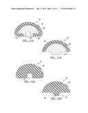 SHOULDER PROSTHETIC diagram and image