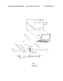 METHOD AND SYSTEM FOR ASSESSING ORTHOPEDIC ALIGNMENT USING TRACKING     SENSORS diagram and image