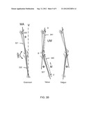 METHOD AND SYSTEM FOR ASSESSING ORTHOPEDIC ALIGNMENT USING TRACKING     SENSORS diagram and image