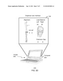 METHOD AND SYSTEM FOR ASSESSING ORTHOPEDIC ALIGNMENT USING TRACKING     SENSORS diagram and image