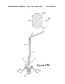 Combination Feeder For A Knitting Machine diagram and image