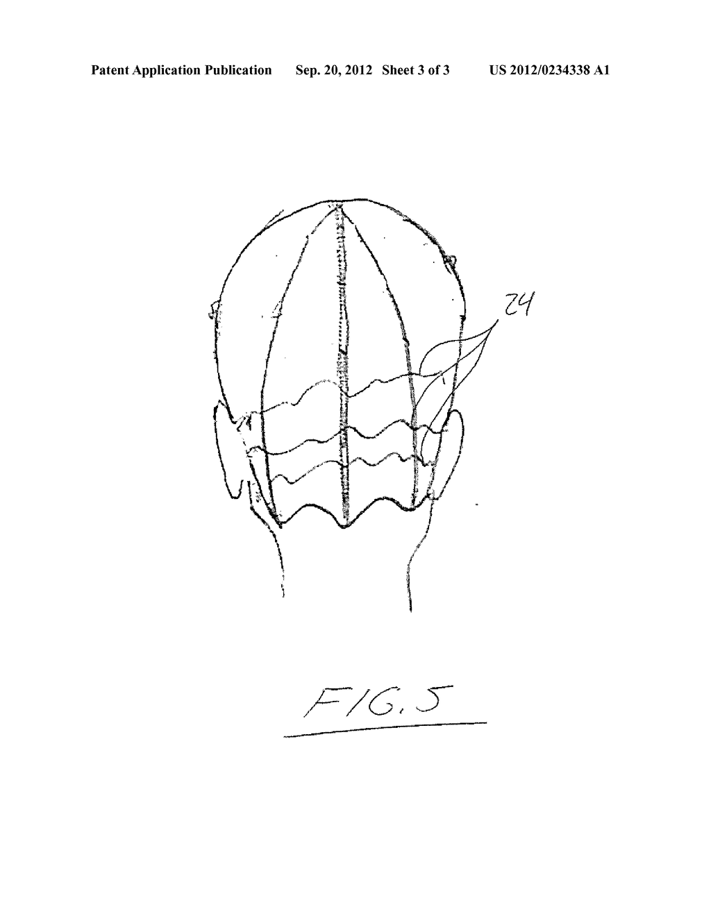 Apparatus and Methods for Hair Extensions - diagram, schematic, and image 04